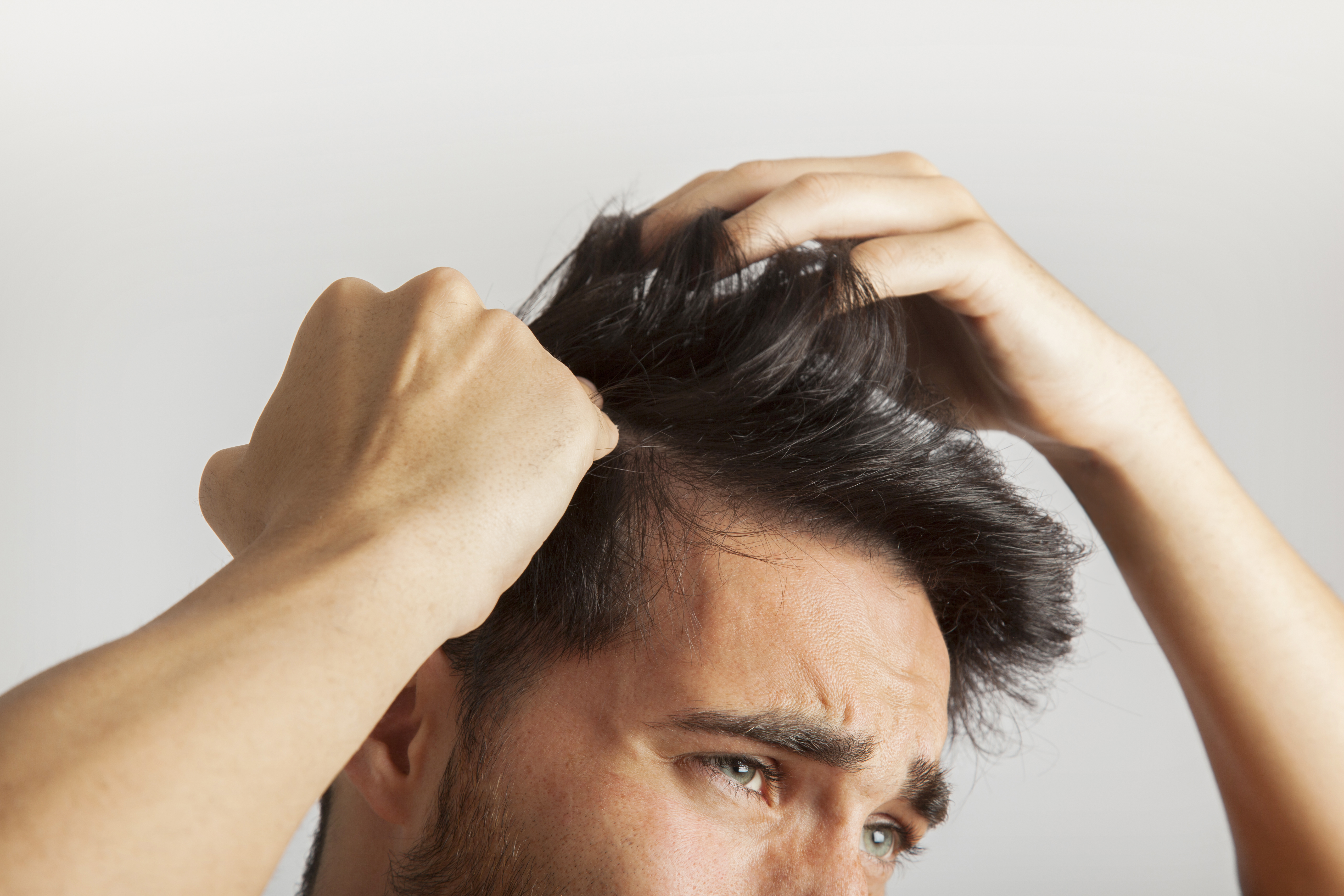 8 Things to Know before Hair transplant- FUE or FUT